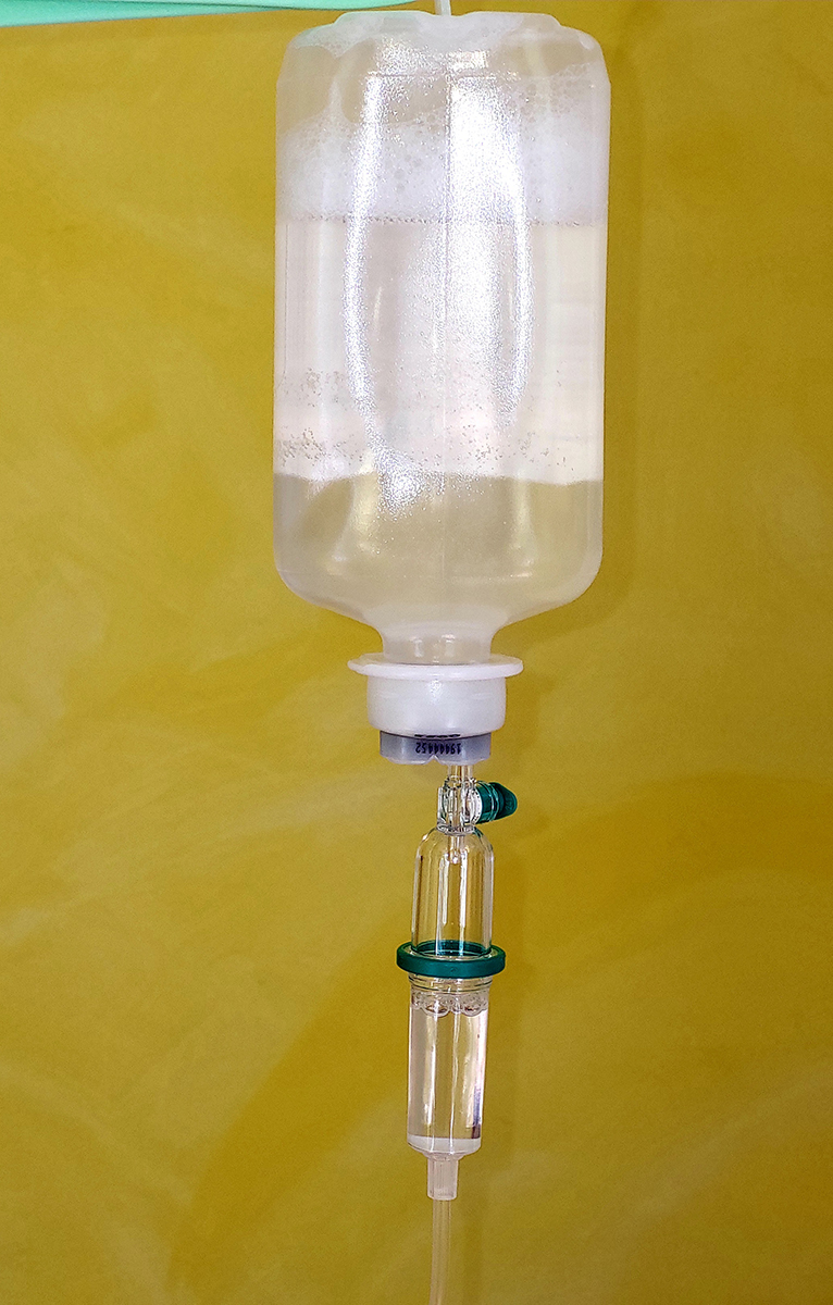 Augmentation-therapy - Alpha-1-Anitrypsin-Deficiensy
