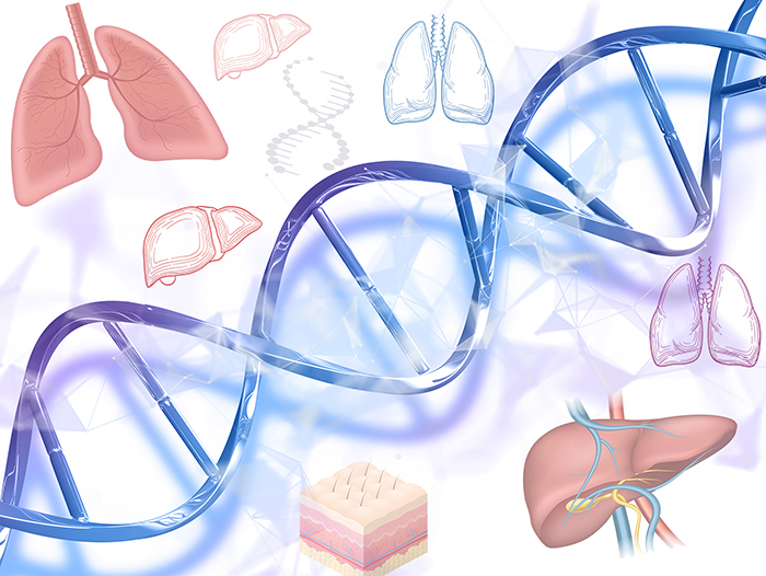 What is Alpha-1 Antitrypsin Deficiency